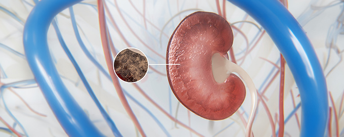 Kidney fibrosis - Zoetis